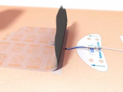 IV3000◊ IV Dressing 10x12cm 4008 application