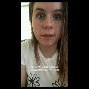 Learn Why Customers Give Us ⭐⭐⭐⭐⭐ 3,441 Reviews ✓ All Natural & Baby Safe ✓ No Steroids, Parabens, etc ✓ Handmade in the USA See for yourself ➡️ https://eczemahoneyco.com | Eczema Honey Co | Facebook