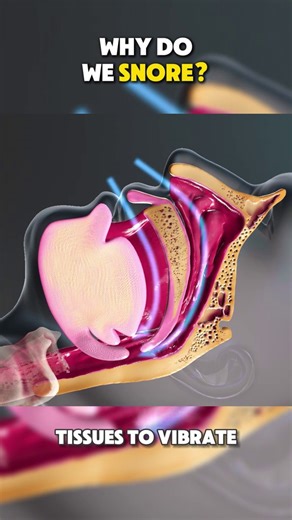 Why Do We Snore 3D Animation #snore #snoring #sleepapnea #sleepapneacause #snorecause #snoringcauses #snoretreartment #snoringtreatment #medical3danimation #3dmedicalanimation | Surgery Page