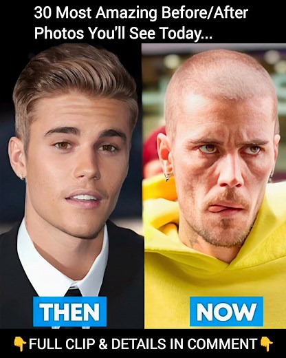 30 Most Amazing Before/After Photos You'll See Today | Celebrity Blog 247