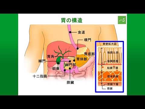 胃がんとは（総論）