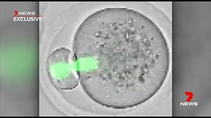Researchers have made a surprise world-first discovery when it comes to ageing and IVF. Time lapse imaging has revealed why egg quality declines as women get older. www.7NEWS.com.au #Health #7NEWS | 7NEWS Sydney