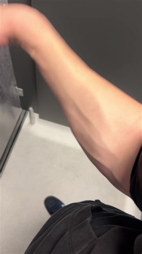 Is there an explanation for this bump on my arm 😭😭