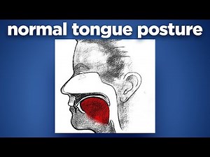 Normal Tongue Posture by Prof John Mew