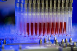 Moderna Vaccine Shows Signs It Can Stop Virus From Replicating, CEO Says