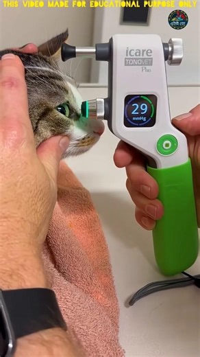 Use of Eye Pressure Tester Machine #shorts