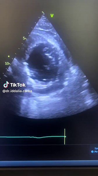 Diagnosing Chest Pain and Difficulty Swallowing in Seniors