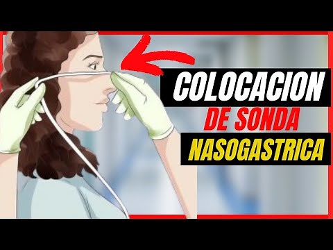 👉😱 Placement of nasogastric tube, pediatric and adult nursing care, technique