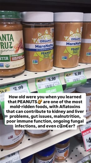 Allyssa LaScala - Integrative Health Practitioner on Instagram: "Were you today years old?🙃 This isn’t meant to scare you away from ever enjoying a PB&J🥜🍇, or throwing a spoonful of peanut butter in your smoothie every so often. But especially if you consume them regularly in higher volume and are dealing with chronic health challenges such as: 🔻Brain fog 🔻Chronic Fatigue / non restful sleep 🔻Depression 🔻Anxiety 🔻Mood swings 🔻Body rashes / skin conditions 🔻Sinus infections 🔻Runny, blo