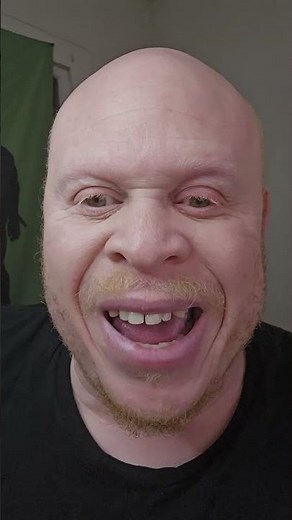 a step-by-step guide on how to make a black albino.