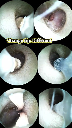 @bebirdofficial Proper Ear Hygiene Guide