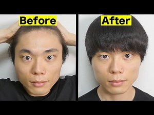 ハゲを効果的に改善する「とっておきの方法」