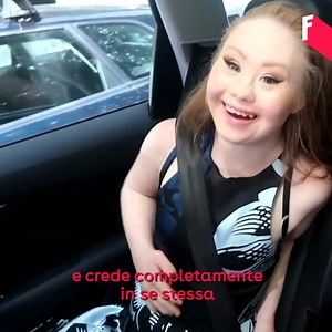 2M views · 41K reactions | Madeline Stuart ha 22 anni ed è la prima ragazza con sindrome di down che è riuscita a diventare una modella professionista. Nel 2015 è scesa in passerella durante la settimana della moda di New York, e da allora non si è mai fermata, diventando famosa in tutto il mondo, e dimostrando che nessuna etichetta sociale può incasellare i nostri talenti | Freeda | Facebook