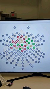 Help! Jumping impedance levels with EEG-Setup.