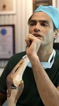 Meniscus Tear MRI Explained + Best Treatment Options #meniscustear #shorts