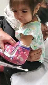 cast & pin removal (Supracondylar elbow fracture)