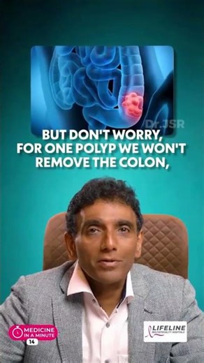 What REALLY Happens When Polyps Turn into Cancer