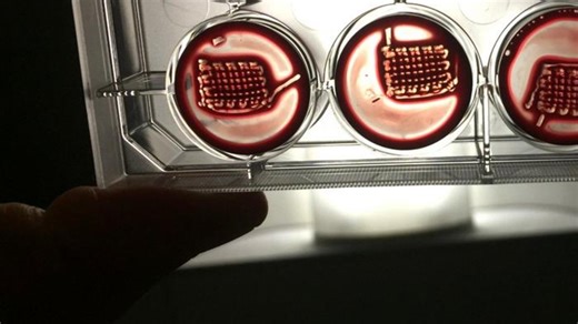 Scientists turn blood into 3D-printed bone repair material
