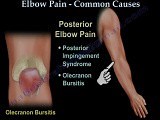 Common Causes of Elbow Pain - Video Lecture • Video • MEDtube.net