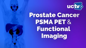 VIDEO: Prostate Cancer: PSMA PET and Functional Imaging