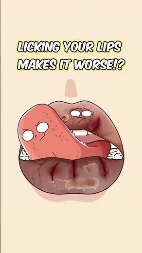 Licking your lips makes it WORSE!?