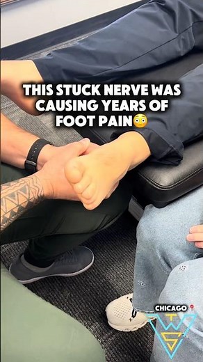 This Stuck Nerve Was Causing YEARS of Foot Pain