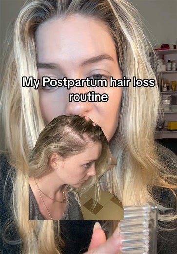 Rutina de crecimiento capilar postparto