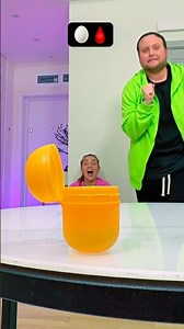 EGG PRANK🔮😂 What did he crush?🥶🩸