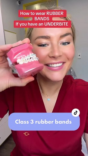 How to Wear Rubber Bands for Underbite Correction
