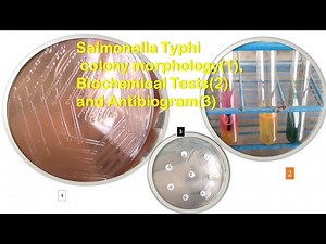 Salmonella Typhi colony morphology, Biochemical Tests and Antibiogram