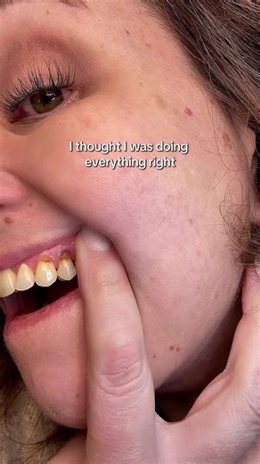 Hydroxyapatite Toothpaste Tablets for Enamel Care