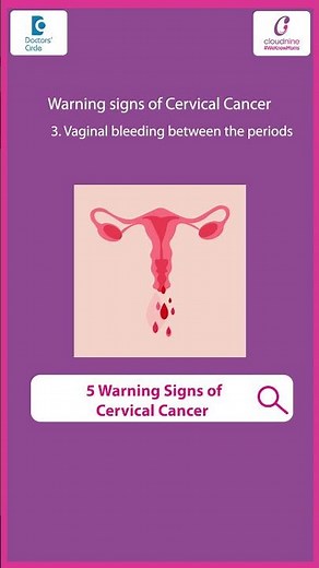 Cervical cancer symptoms | Vaginal Smell | Heavy Periods | Signs of #cervicalcancer - Dr.Vatsala B H