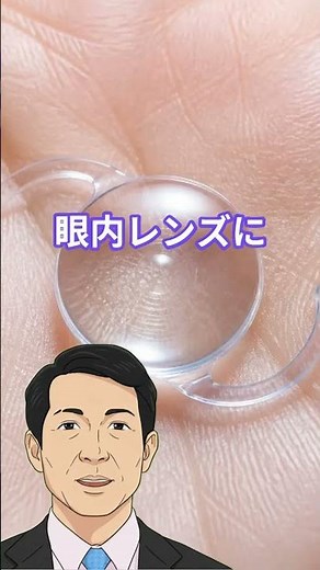 白内障の衝撃！霞む視界を劇的に変える最新手術の全貌