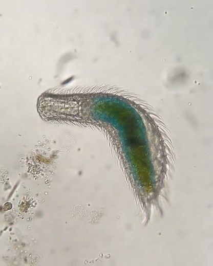 Gastrotricha under the microscope.