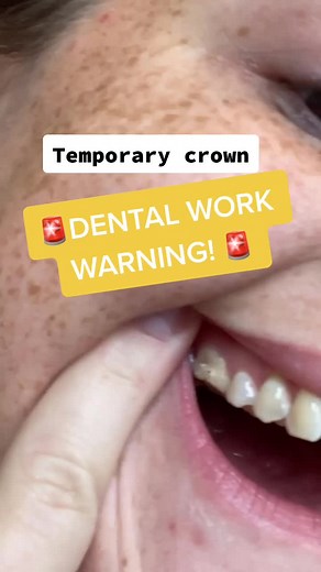 Temporary Crown: How to Remove and its Defaux de mise en place des couronnes