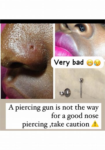 #piercer #fyp#gunpiercinggonewrong #wrongturn #bad#botchedpiercing #viral#trending#piercingsoftiktok #blowthisupforme #safetyfirst #piercingsbystayc #zimtiktokers🇿🇼🇿🇼🇿🇼 #zimbabwe #fyppppppppppppppppppppppp #nosepiercing #botched #🙌