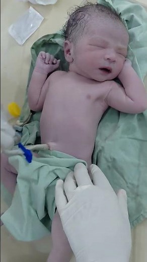 Just delivery newborn baby cord clamp process #cutebaby #newbornbaby #youtubeshorts #viralvideo