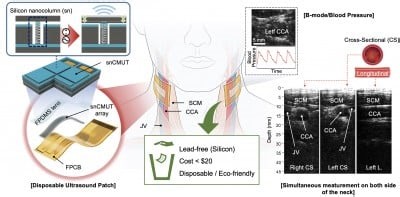 Development of Silicon Ultrasound Patch Achieves Both Eco-Friendliness and Performance Enhancement | Newswise