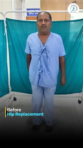 Life After Hip Replacement Surgery |Before & After Patient Recovery Journey |Dr. Rajat Jangir #short