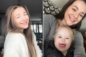 Woman Is Diagnosed With Down Syndrome as an Adult After Warning Signs