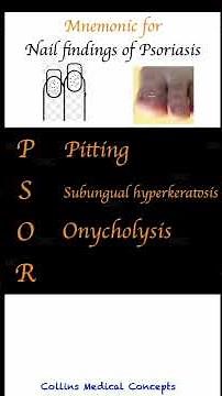 Master Nail Psoriasis Signs with This Easy Mnemonic