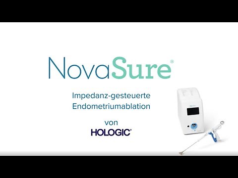 NovaSure® – Impedanz-gesteuerte Endometriumablation