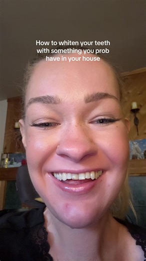 Alex Dacy (@wheelchair_rapunzel)’s video of teeth whitening at home