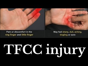 That Clicking Wrist Pain Means This Is Happening