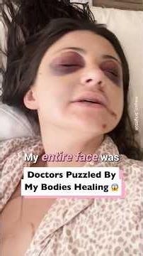 Doctors Confused Over My Swollen Eyes 👀👩‍⚕️