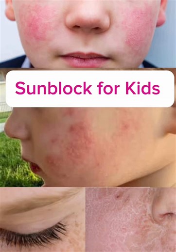 Best Tinted Sunblock for Kids by Dr. Javeria Jia