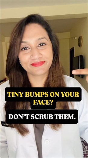 TINY BUMPS ON FACE? 🚨 Don’t Scrub! Try This Acne Routine | Closed Comedones + Clogged Pores