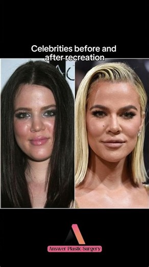Celebrities before and after recreation | Answer Plastic Surgery #shorts