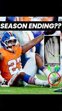 Doctor explains JK Dobbins foot injury (Lisfranc) & surgery #broncos #fantasyfootball #education