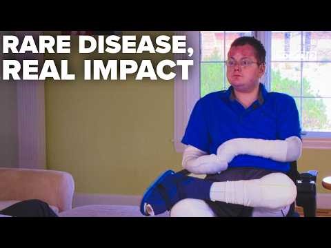 Ohio 'Butterfly Syndrome' survivor works to aid those with rare genetic disorder